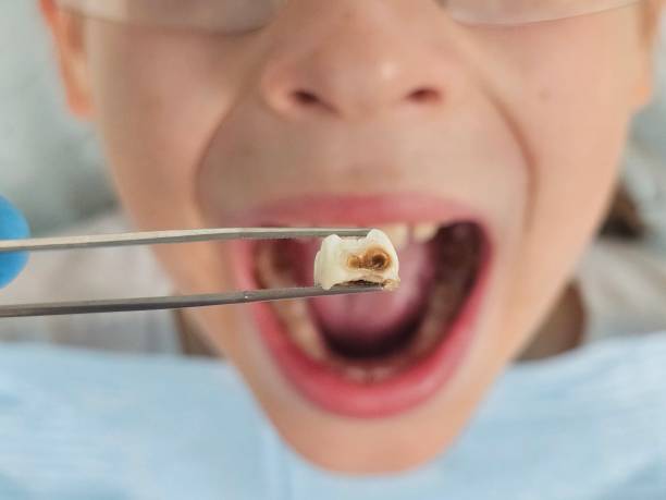 Best Cracked Tooth Emergency Dentist  in Hinckley, IL